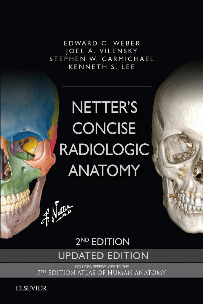 Netter‘s Concise Radiologic Anatomy Updated Edition E-Book