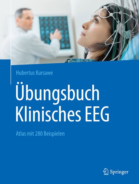 Springer-Verlag GmbH Übungsbuch Klinisches Eeg