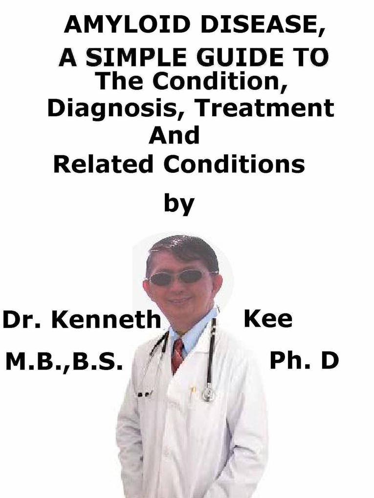 Amyloid Disease A Simple Guide To The Condition Diagnosis Treatment And Related Conditions