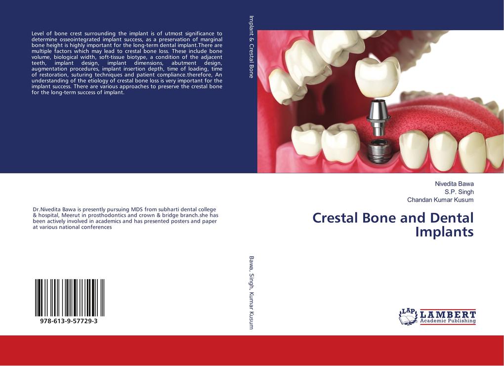 Crestal Bone and Dental Implants