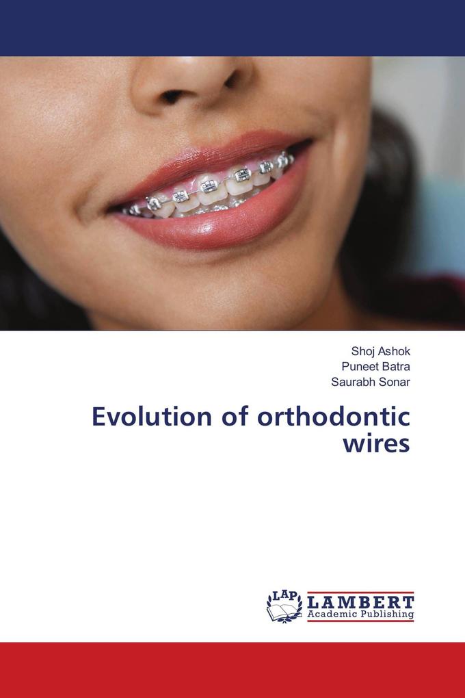 Evolution of orthodontic wires