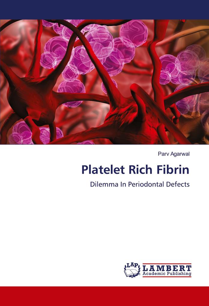 Platelet Rich Fibrin