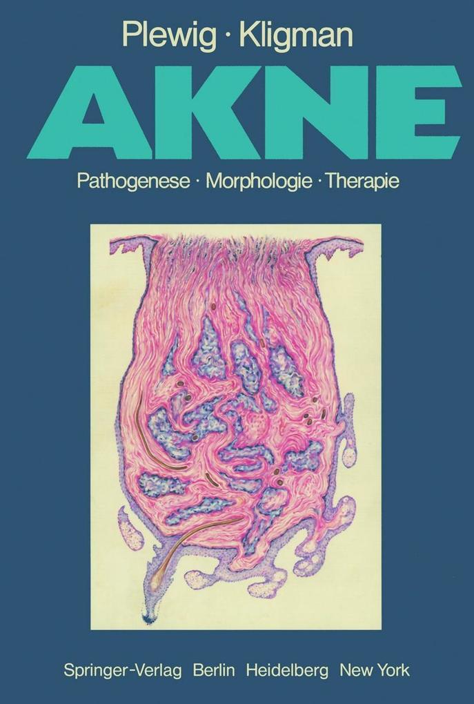 Akne
