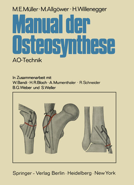 Manual der Osteosynthese