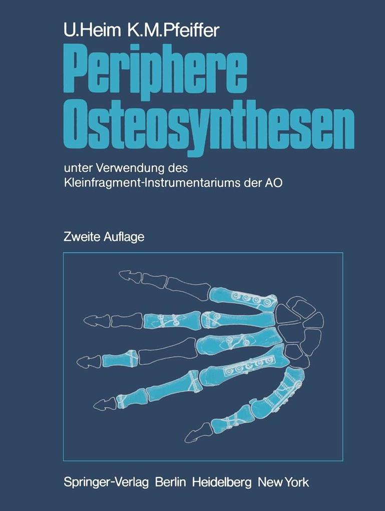 Periphere Osteosynthesen - U. Heim/ K. M. Pfeiffer