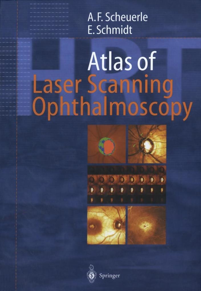 Atlas of Laser Scanning Ophthalmoscopy - Alexander Friedrich Scheuerle/ Eckart Schmidt