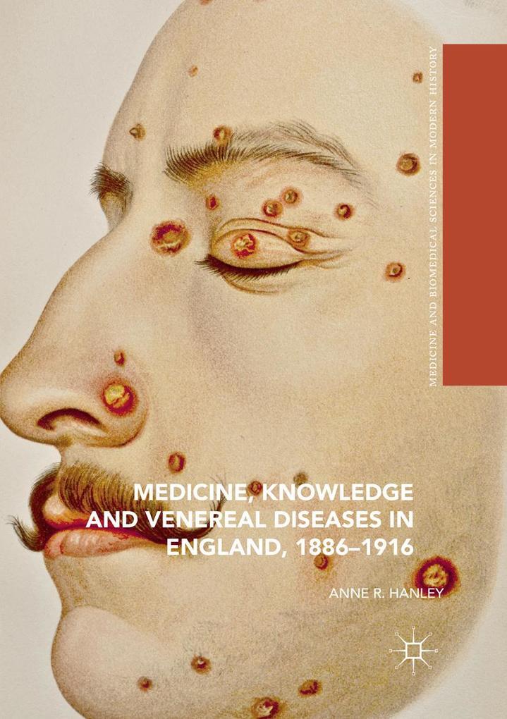 Medicine Knowledge and Venereal Diseases in England 1886-1916