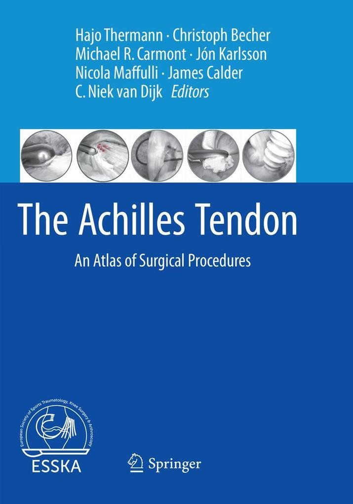 The Achilles Tendon