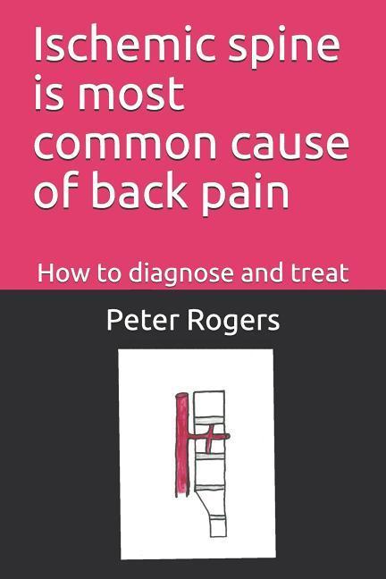 Ischemic Spine Is Most Common Cause of Back Pain: How to Diagnose and Treat