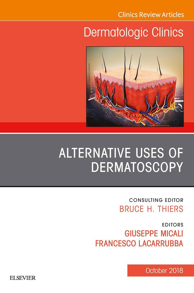Alternative Uses of Dermatoscopy An Issue of Dermatologic Clinics