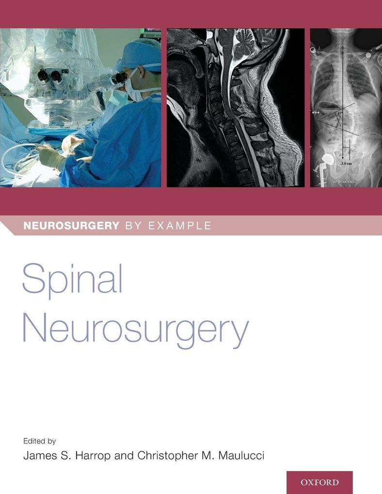 Spinal Neurosurgery