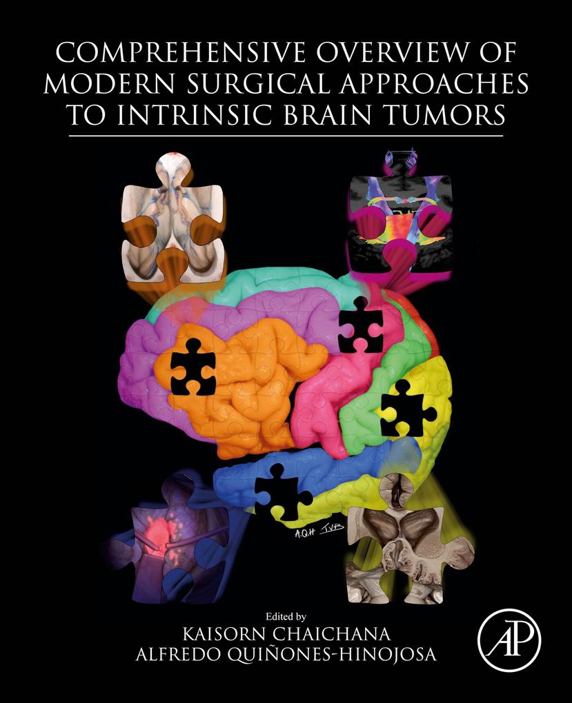 Comprehensive Overview of Modern Surgical Approaches to Intrinsic Brain Tumors