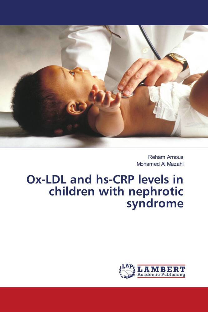 Ox-LDL and hs-CRP levels in children with nephrotic syndrome