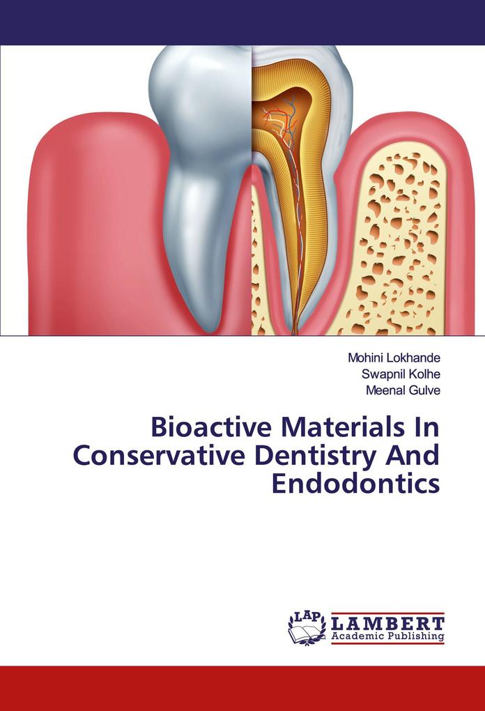 Bioactive Materials In Conservative Dentistry And Endodontics