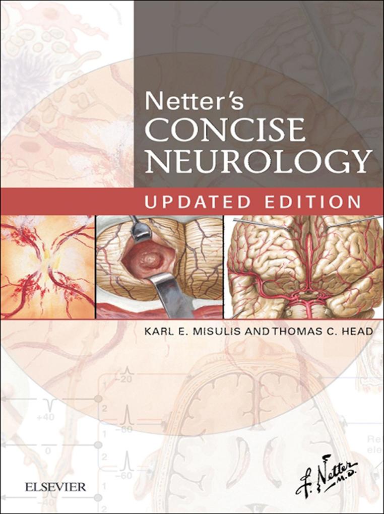 Netter‘s Concise Neurology Updated Edition E-Book