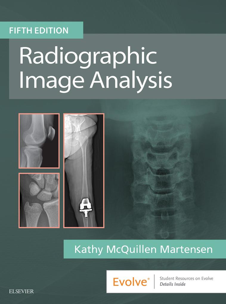 Radiographic Image Analysis E-Book