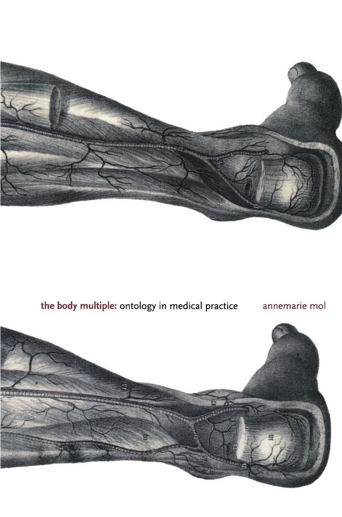 Body Multiple
