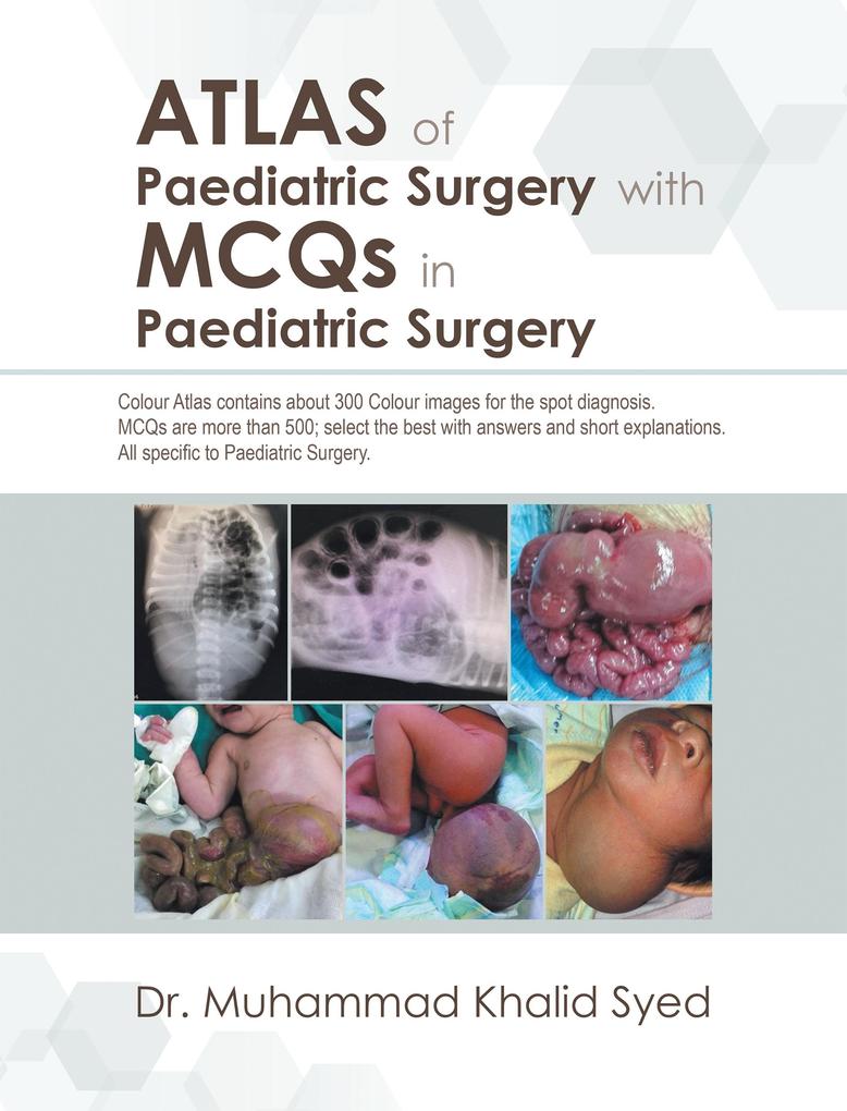Atlas of Paediatric Surgery with Mcqs in Paediatric Surgery
