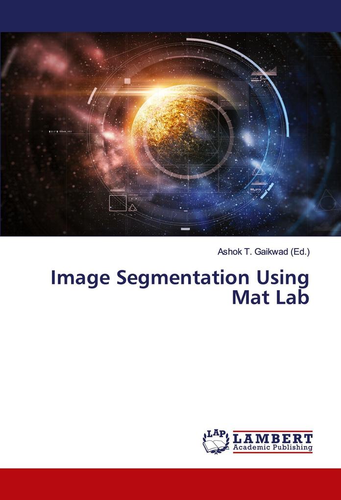 Image Segmentation Using Mat Lab