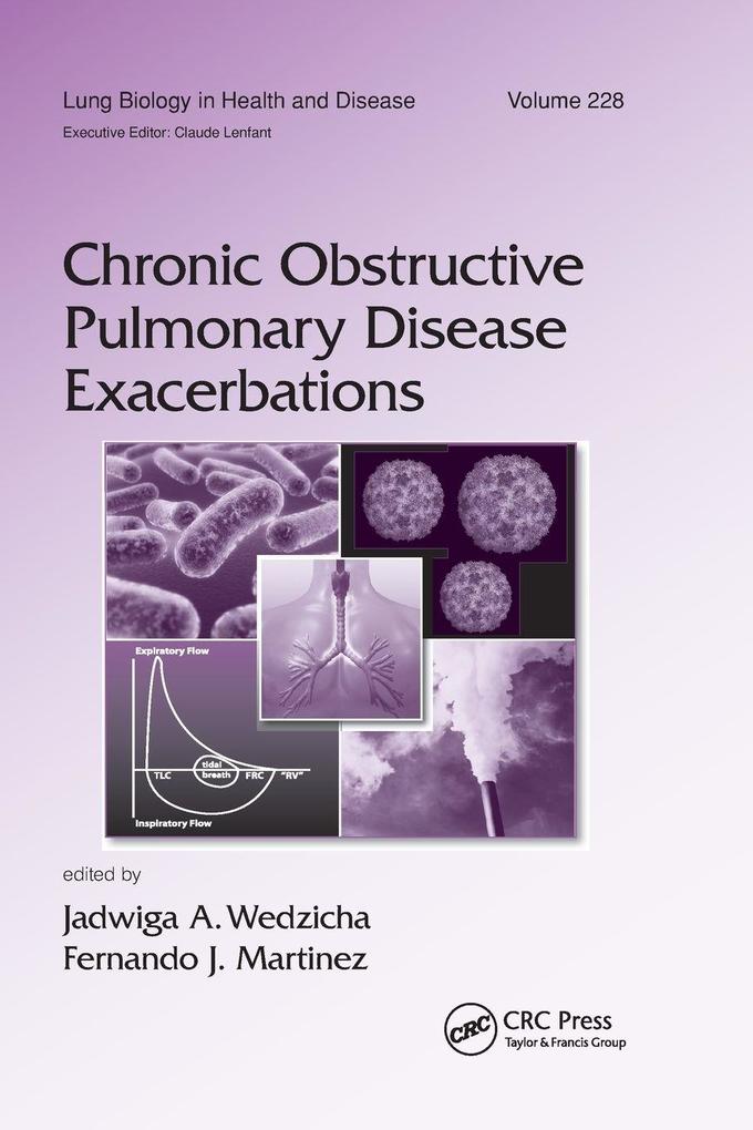 Chronic Obstructive Pulmonary Disease Exacerbations