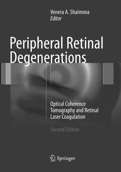 Peripheral Retinal Degenerations