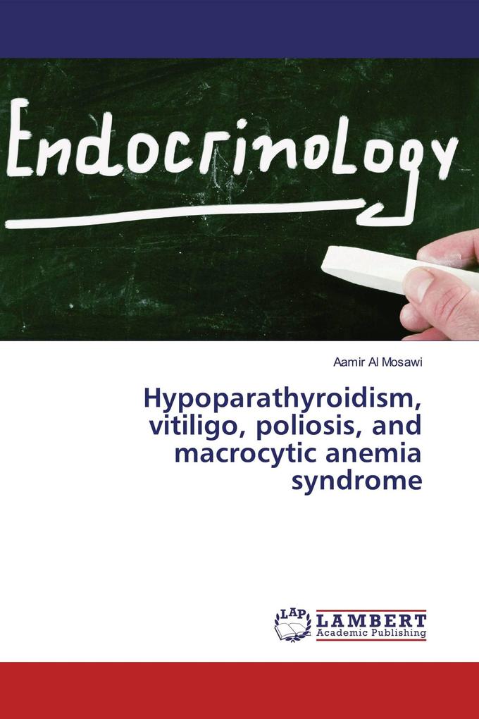 Hypoparathyroidism vitiligo poliosis and macrocytic anemia syndrome