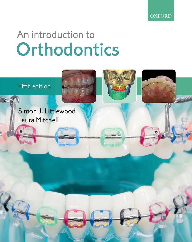 Oup eBook An Introduction To Orthodontics