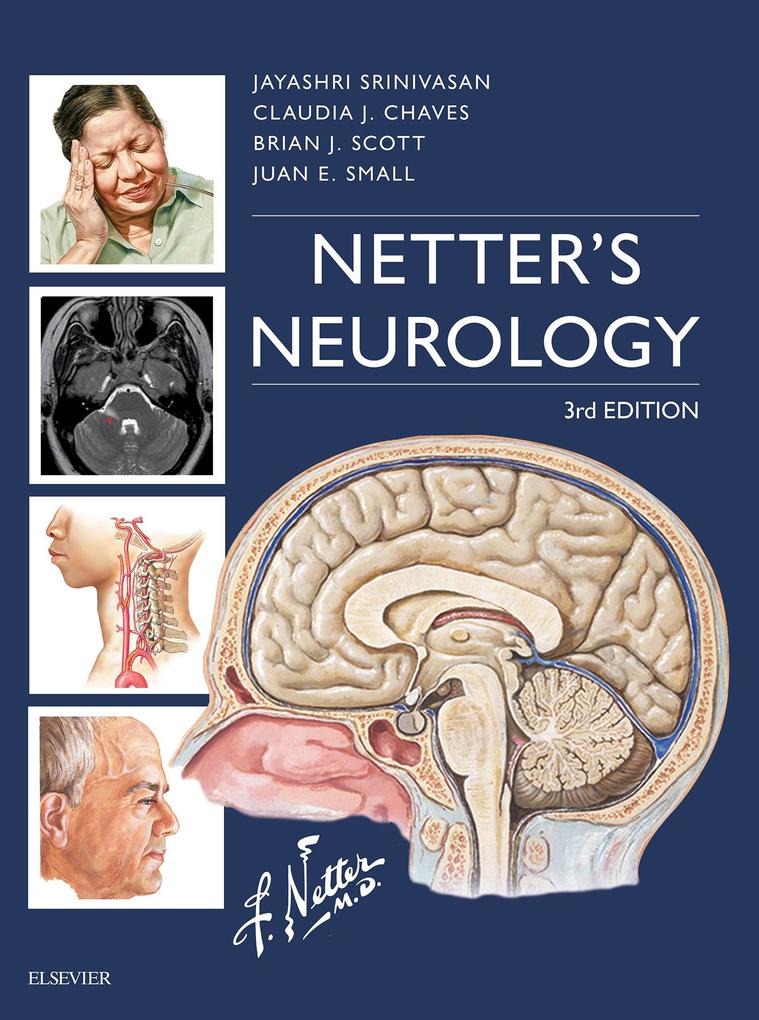 Netter‘s Neurology E-Book