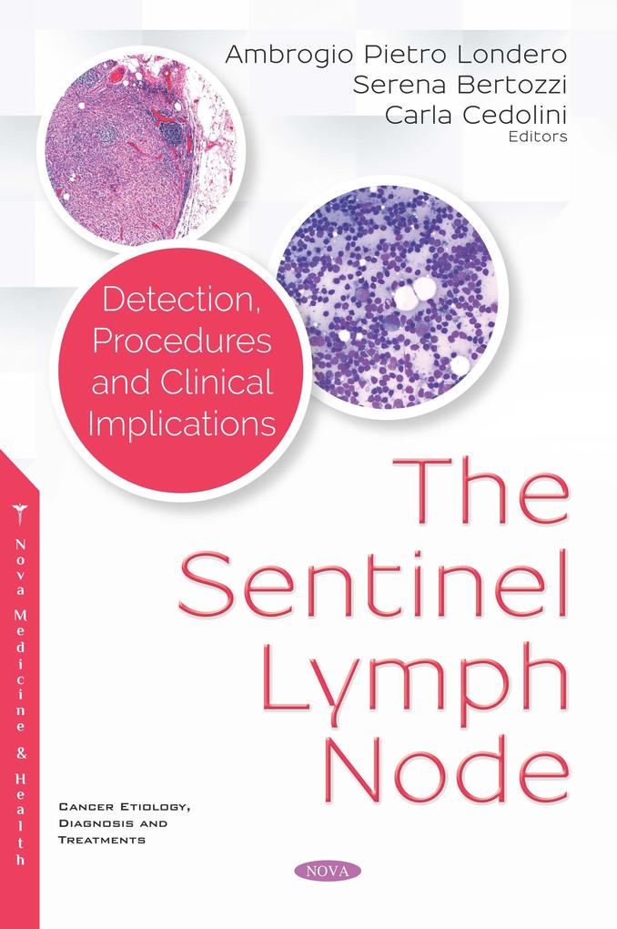 Sentinel Lymph Node: Detection Procedures and Clinical Implications