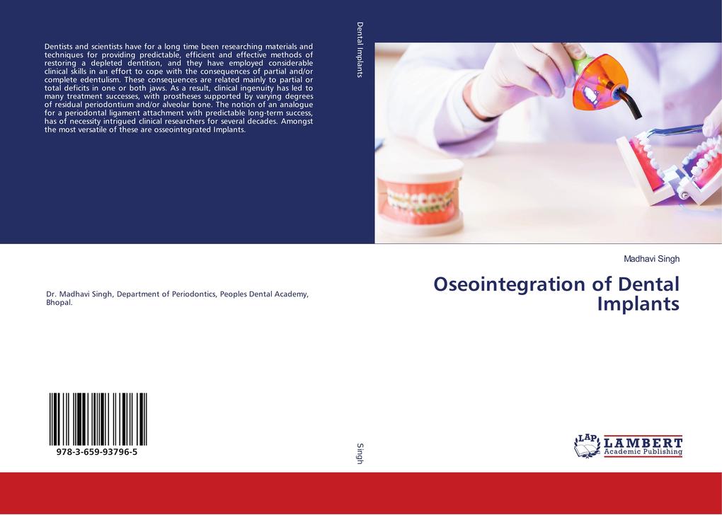 Oseointegration of Dental Implants