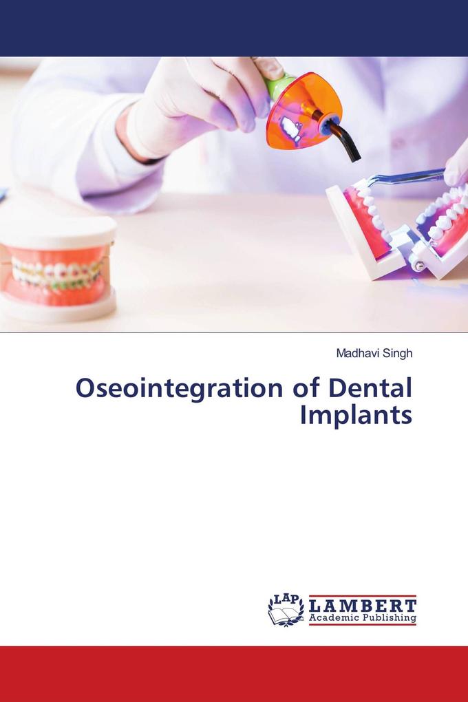 Oseointegration of Dental Implants