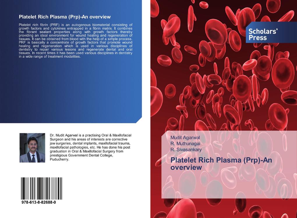 Platelet Rich Plasma (Prp)-An overview