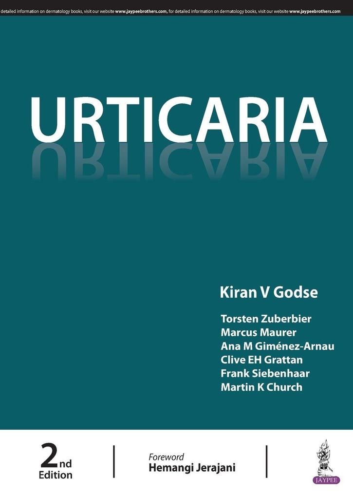 Urticaria
