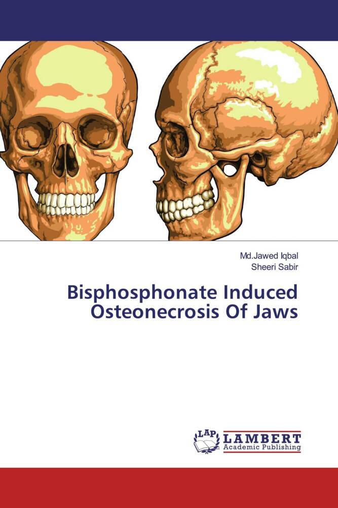 Bisphosphonate Induced Osteonecrosis Of Jaws