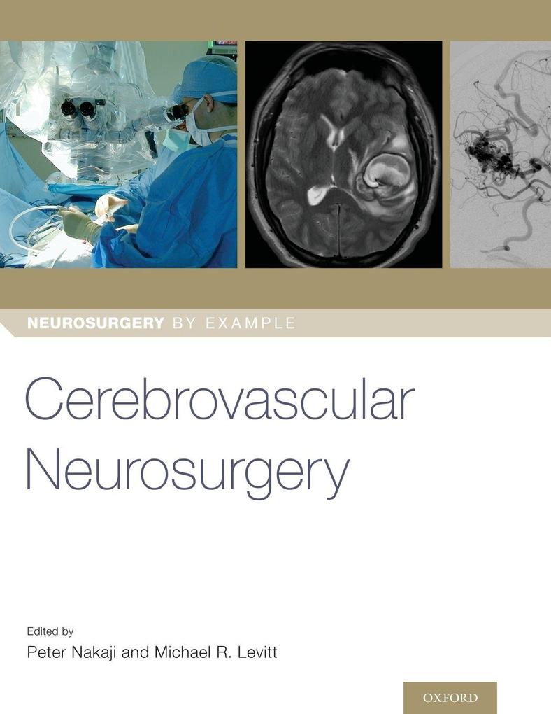 Cerebrovascular Neurosurgery