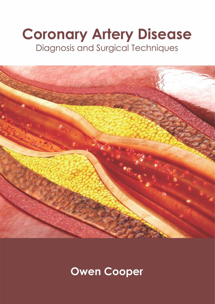 Coronary Artery Disease: Diagnosis and Surgical Techniques