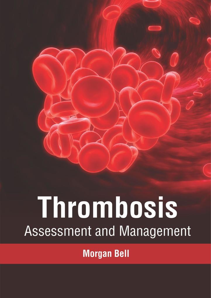 Thrombosis: Assessment and Management