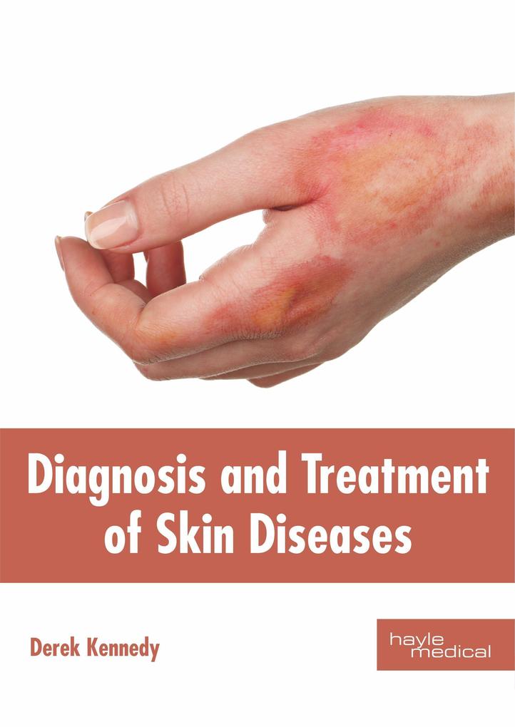Diagnosis and Treatment of Skin Diseases