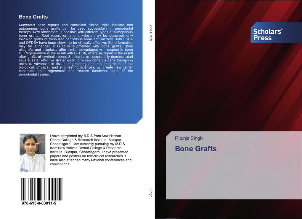 Bone Grafts