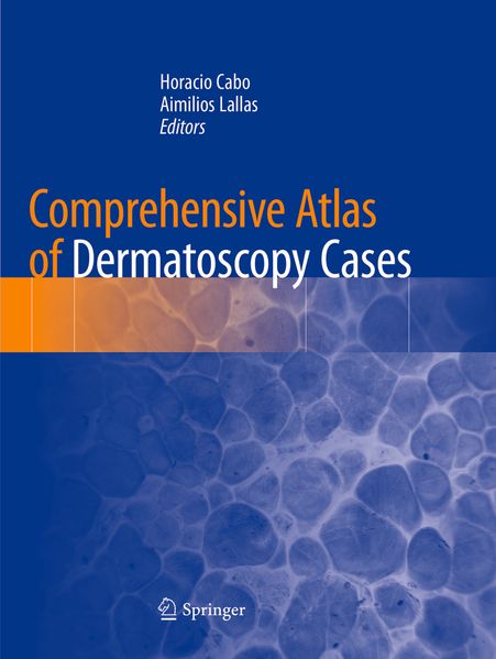 Comprehensive Atlas of Dermatoscopy Cases