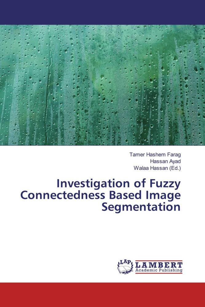 Investigation of Fuzzy Connectedness Based Image Segmentation