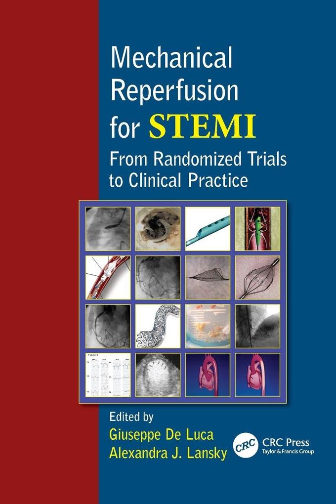 Mechanical Reperfusion for STEMI