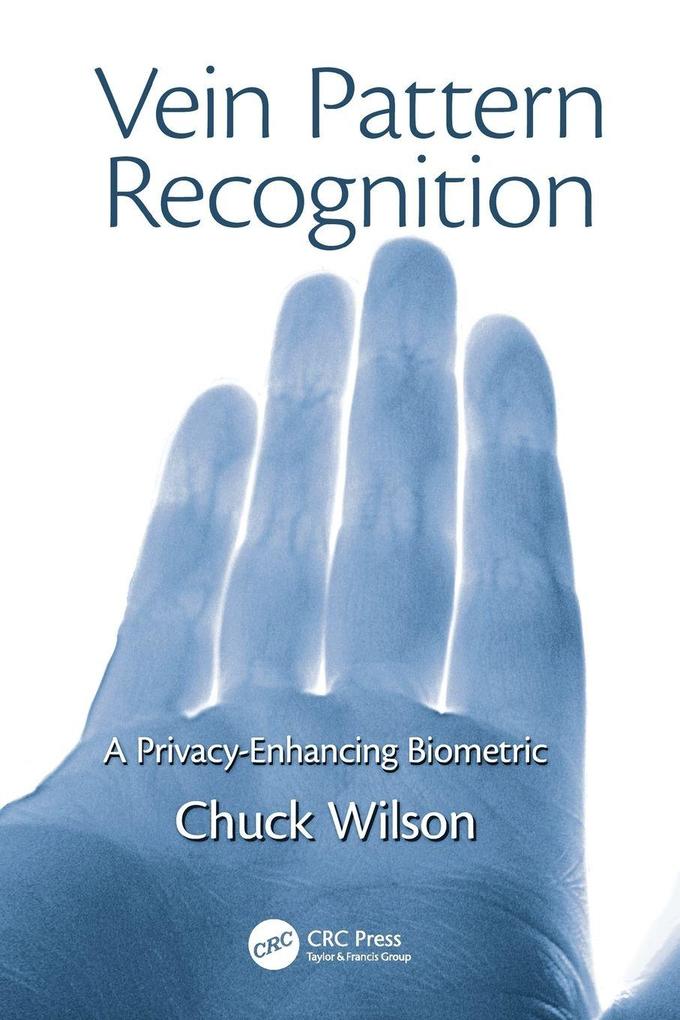Vein Pattern Recognition