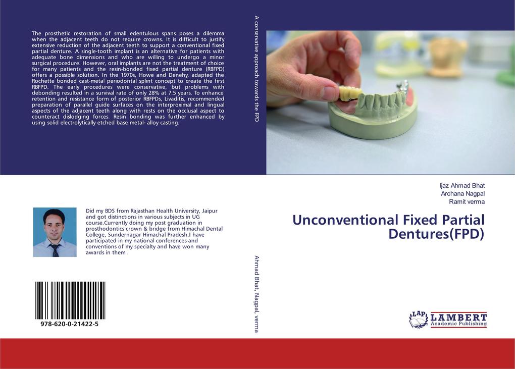 Unconventional Fixed Partial Dentures(FPD)