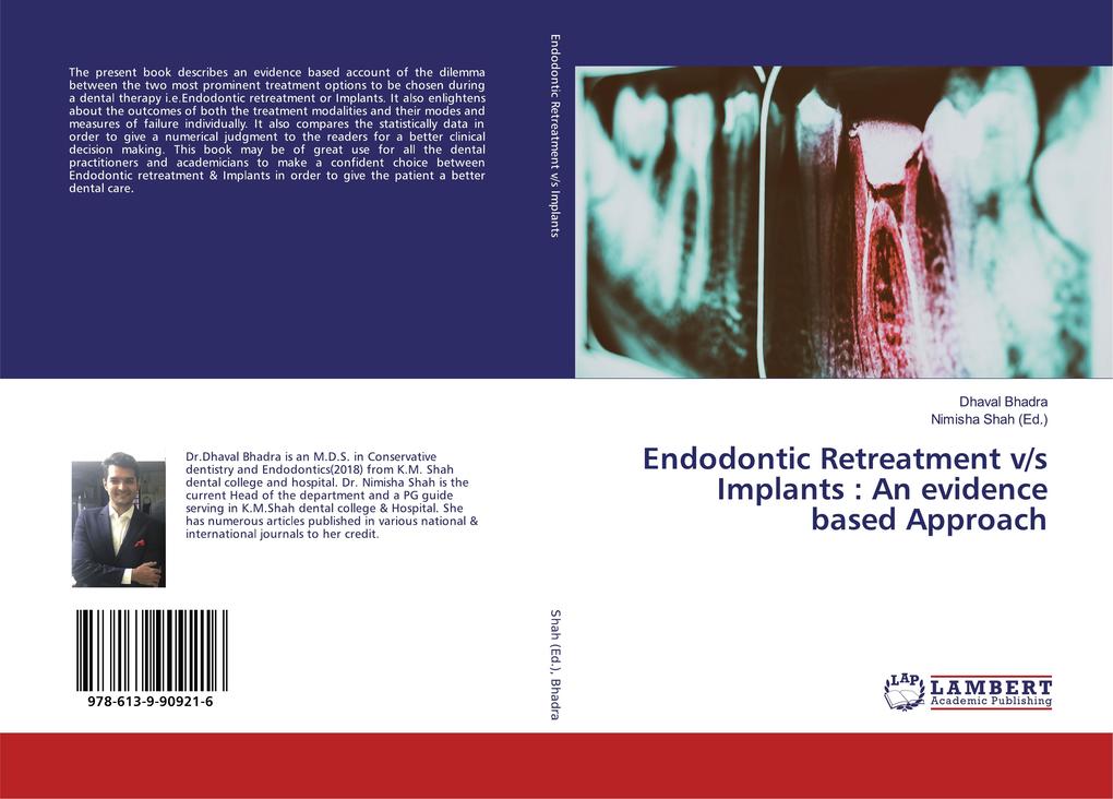 Endodontic Retreatment v/s Implants : An evidence based Approach