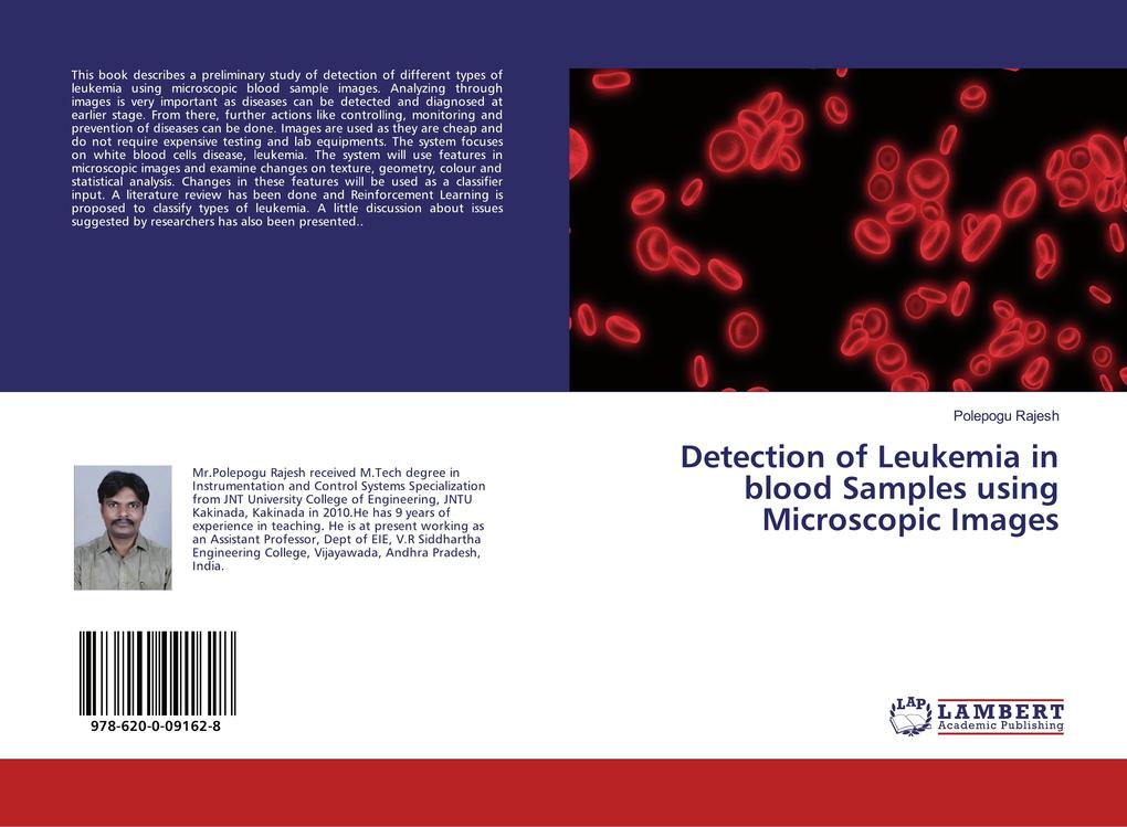 Detection of Leukemia in blood Samples using Microscopic Images