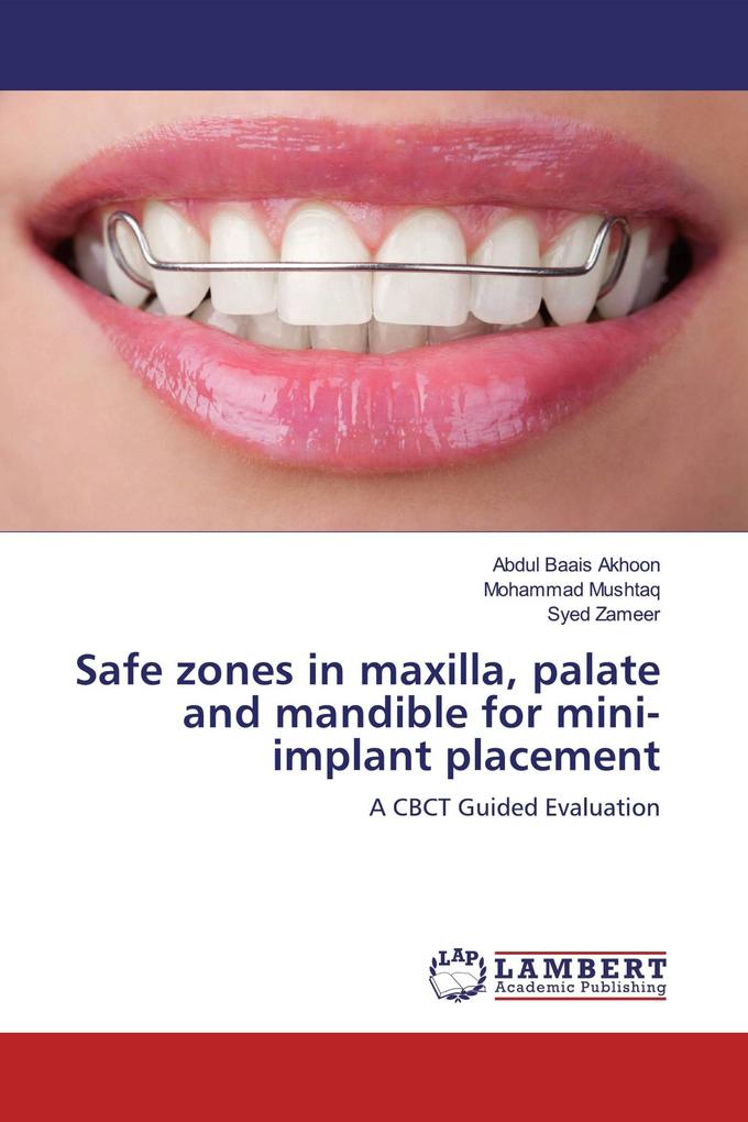 Safe zones in maxilla palate and mandible for mini-implant placement