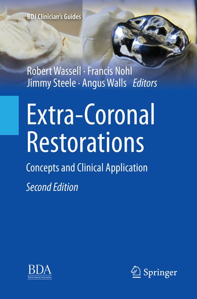 Extra-Coronal Restorations