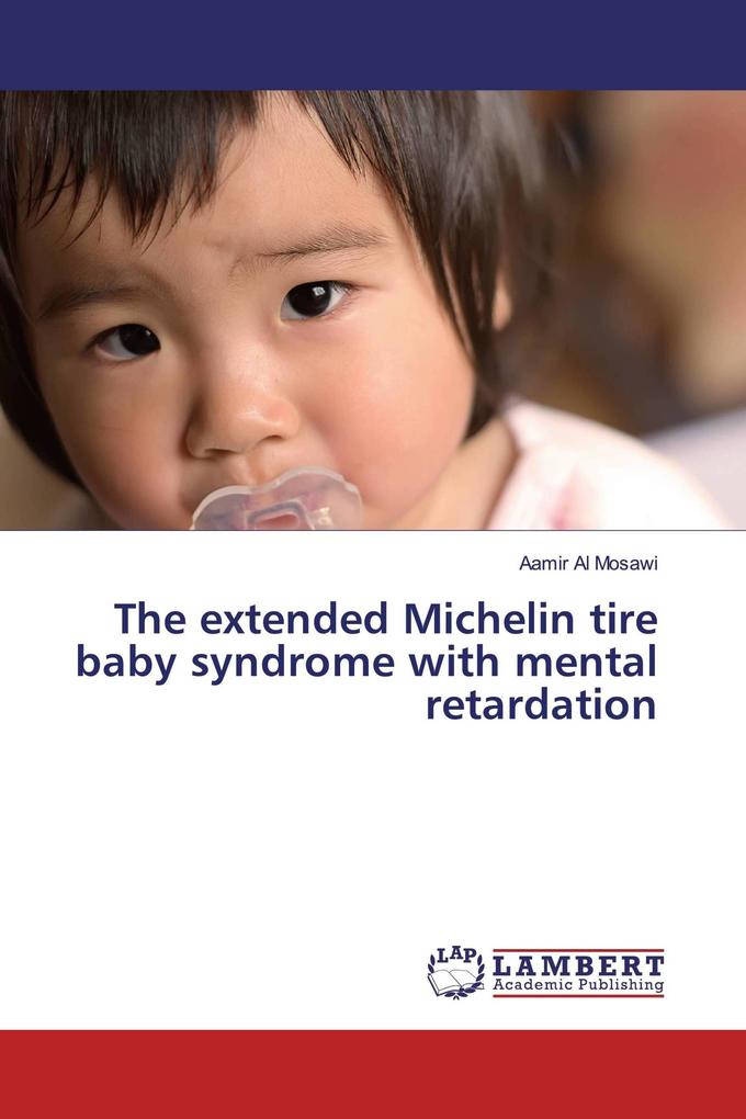 The extended Michelin tire baby syndrome with mental retardation