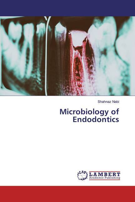 Microbiology of Endodontics
